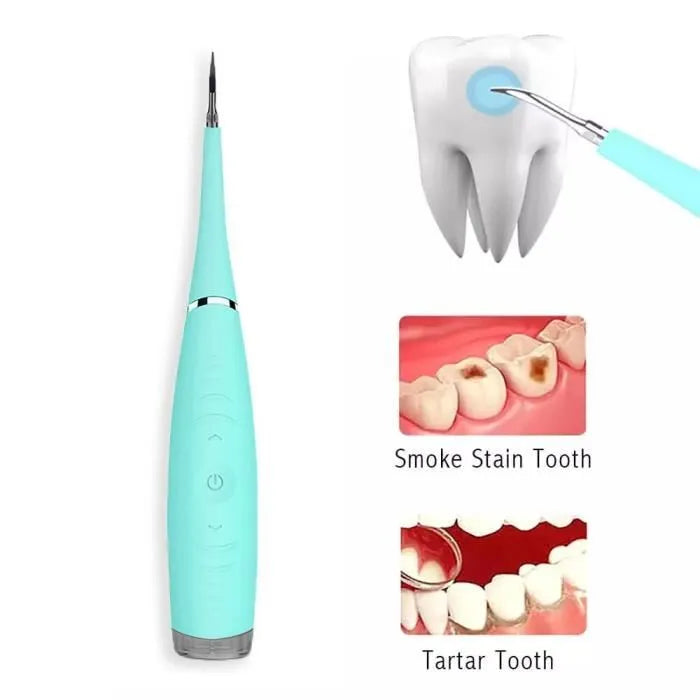 DENTPAL™ - Removedor de Cálculo Dental