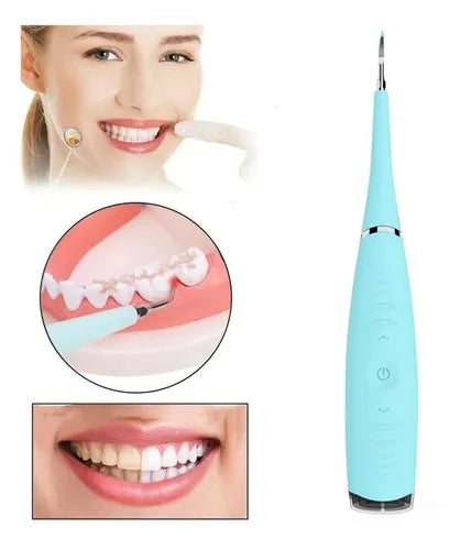 DENTPAL™ - Removedor de Cálculo Dental