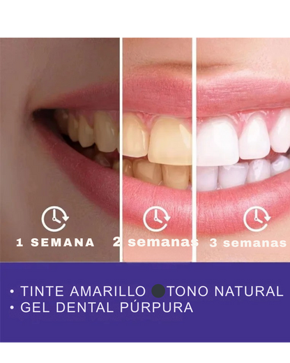 PurpleSmile Blanqueadora